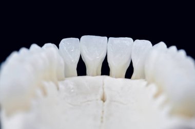 Dişleri siyah arkaplanda izole edilmiş insan çenesi