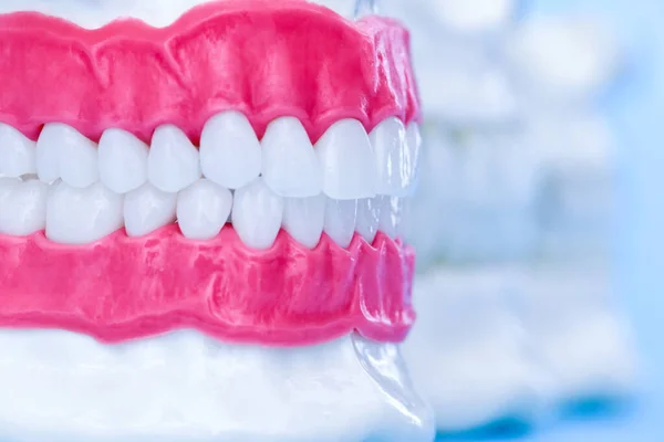 Mandíbulas humanas com modelos anatômicos de dentes e gengivas — Fotografia de Stock