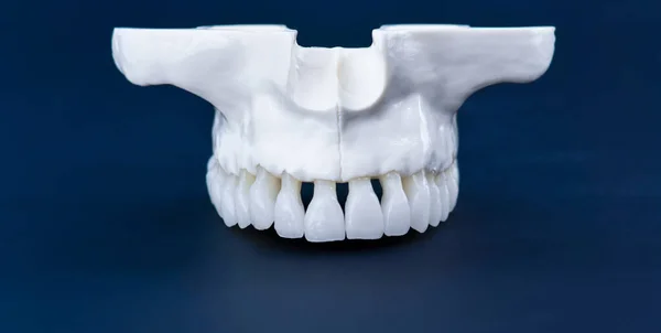 Mandíbula humana superior con dientes — Foto de Stock