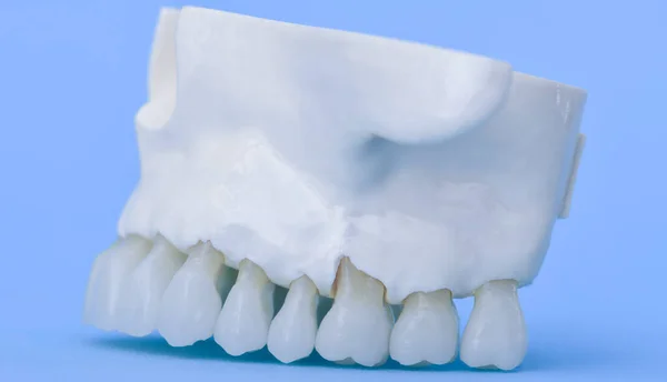 Felső emberi állkapocs fogakkal — Stock Fotó