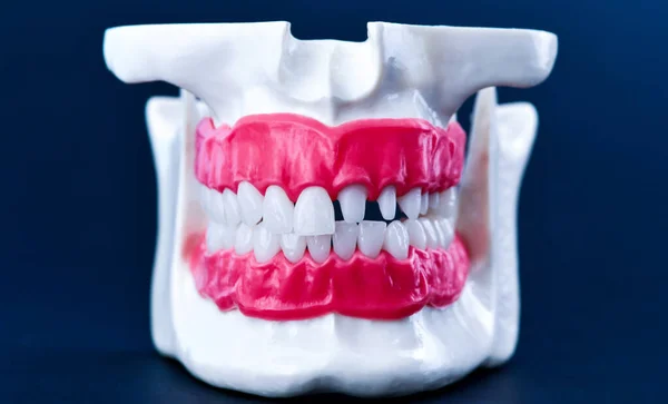 Anatomiemodell menschlicher Kiefer mit Zähnen und Zahnfleisch — Stockfoto
