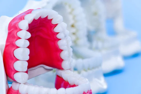 Dentist orthodontic teeth models — Stock Photo, Image