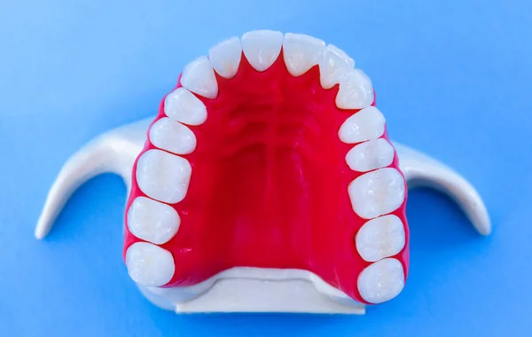 Górna szczęka ludzka z zębami i gumami model anatomiczny — Zdjęcie stockowe