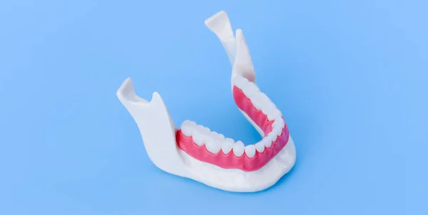 歯と歯茎の解剖学的モデルを持つ下顎人間 — ストック写真