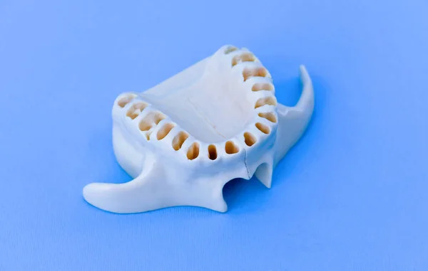 Верхняя челюсть человека без зубов — стоковое фото