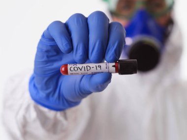 Coronavirus, covid-19, Health, disease, hospital, virus, medical, blood, mers, positive, white, background, medicine, lab, tube, epidemic, test, research, pandemic, lab, corona virus, numune, care, klinik, 2019-ncov, doctor, corona, diagnos