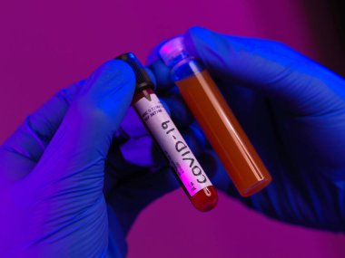 Coronavirus, Doktorun elinde pozitif covid-19 virüsü kan örneği tüpü ve ilaç tedavisi