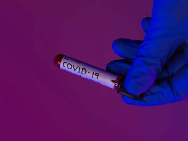 Coronavirus Doctor Sosteniendo Positivo Virus Covid Tubo Muestra Sangre Uso —  Fotos de Stock