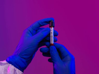 Coronavirus, doktorun elinde kovid 19 virüslü kan örneği tüpü var. Biyolojik tehlike salgını var Koruyucu maske, kostüm ve ışıltı.