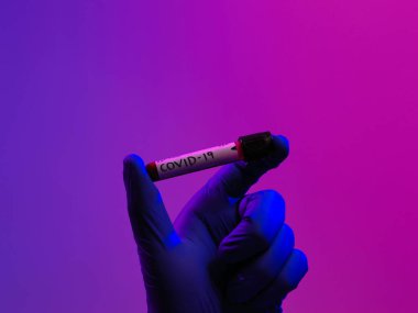 Coronavirus, doktorun elinde kovid 19 virüslü kan örneği tüpü var. Biyolojik tehlike salgını var Koruyucu maske, kostüm ve ışıltı.