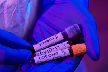 Coronavirus, doktorun elinde kovid 19 virüslü kan örneği test tüpü var. Biyolojik tehlike salgını maskesi, giysisi ve parlak ışık arkaplanı var.
