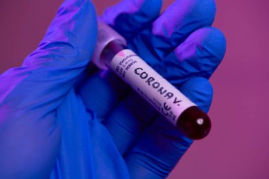 Coronavirus, doktorun elinde kovid 19 virüslü kan örneği test tüpü var. Biyolojik tehlike salgını maskesi, giysisi ve parlak ışık arkaplanı var.