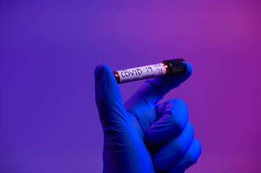 Coronavirus, doktorun elinde kovid 19 virüsü var. Kan örneği test tüpü. Biyolojik tehlike salgını maskesi, giysisi ve parlak ışık arkaplanı var.