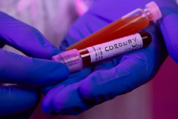 Coronavirus Doctor Sosteniendo Positivo Virus Covid Tubo Prueba Muestra Sangre —  Fotos de Stock