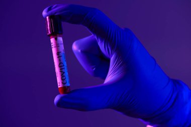 Coronavirus, doktorun elinde kovid 19 virüsü var. Kan örneği test tüpü. Biyolojik tehlike salgını maskesi, giysisi ve parlak ışık arkaplanı var.