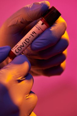 Coronavirus, doktorun elinde kovid 19 virüsü var. Kan örneği test tüpü. Biyolojik tehlike salgını maskesi, giysisi ve parlak ışık arkaplanı var.