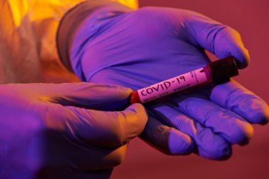 Coronavirus, doktorun elinde kovid 19 virüsü var. Kan örneği test tüpü. Biyolojik tehlike salgını maskesi, giysisi ve parlak ışık arkaplanı var.