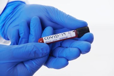 Coronavirus, doktorun elinde kovid 19 virüsü var. Kan örneği test tüpü. Beyaz arka plana karşı koruyucu maske, giysi ve eldiven takan biyolojik tehlike salgını