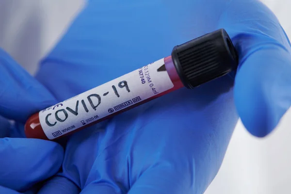 Coronavirus Doctor Sosteniendo Positivo Virus Covid Tubo Muestra Sangre Uso —  Fotos de Stock
