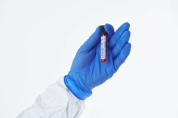 Coronavirus Doctor Holding Positive Covid Virus Blood Sample Test Tube — Stock Photo, Image