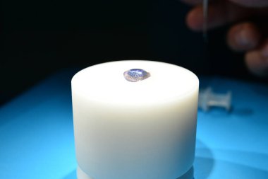 Göz Cerrahi Lazer uygulama