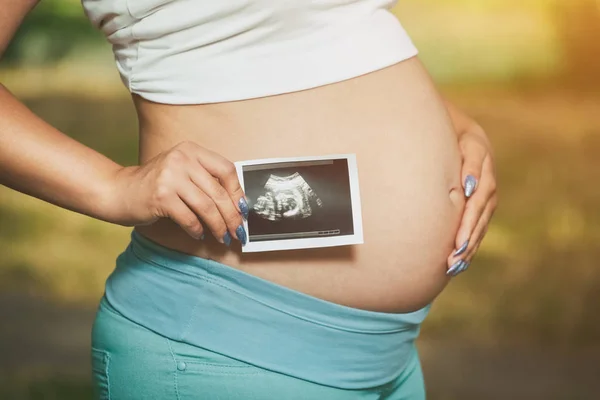 Adult gravid kvinna som håller en foto medicinskt ultraljud — Stockfoto