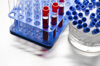 Laboratuvar testleri. Laboratuvarda cam tüplerdeki kan.