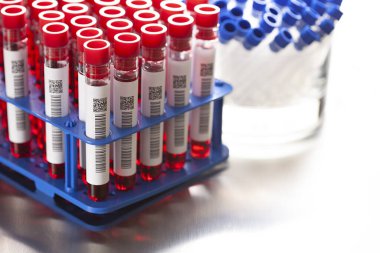 Laboratuvar testleri. Laboratuvarda cam tüplerdeki kan.