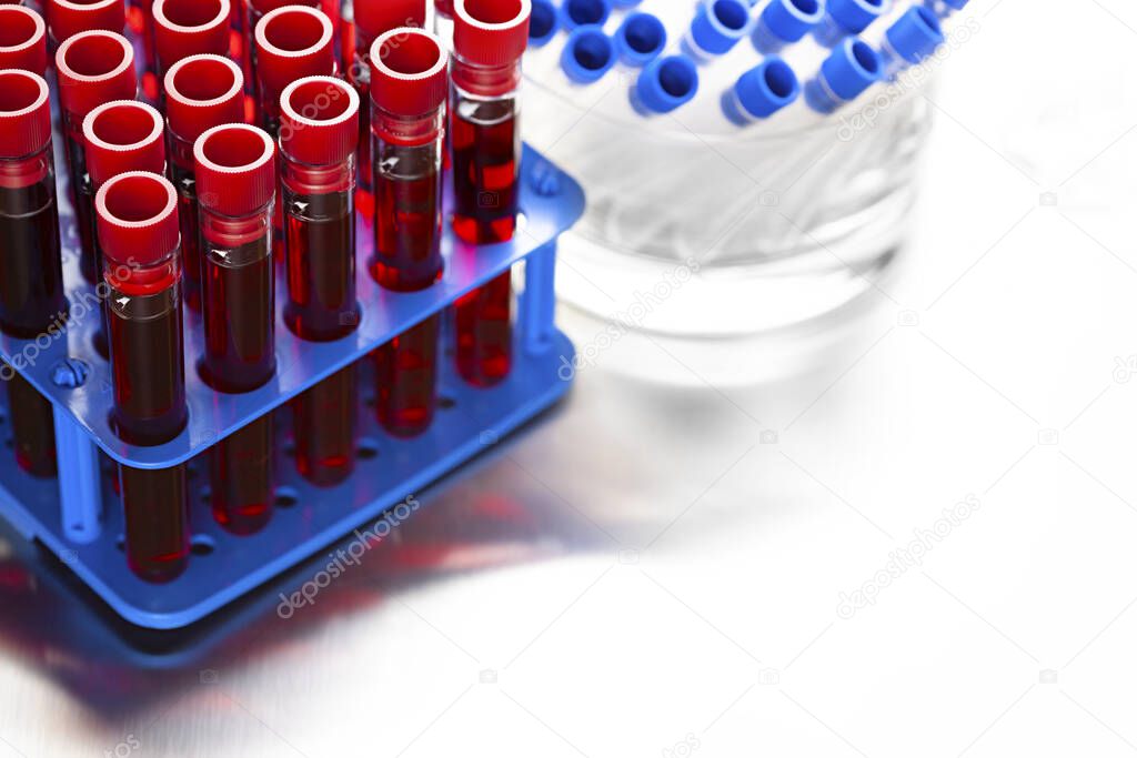 Laboratory tests - blood in glass tubes in a medical laboratory