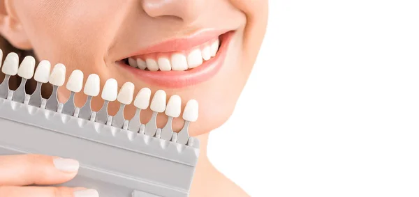 若い女性の美しい笑顔と白い歯 インプラントの色合いや歯のホワイトニングのプロセスを一致させます — ストック写真