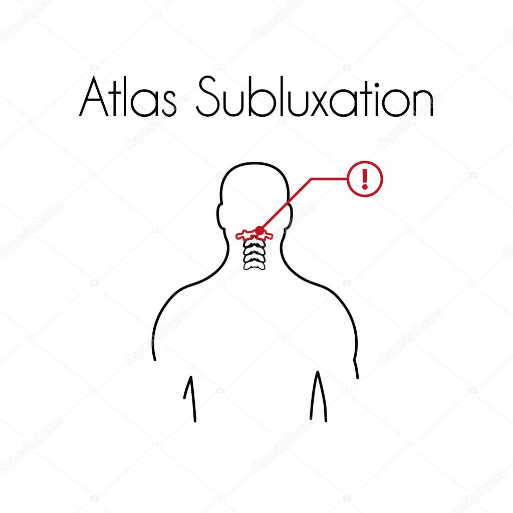 Atlas subluxation linear icon. Vector minimal illustration of young man with red atlas vertebra suffers from pain in the neck. Design template for medicine or therapy for rachiocampsis or backache
