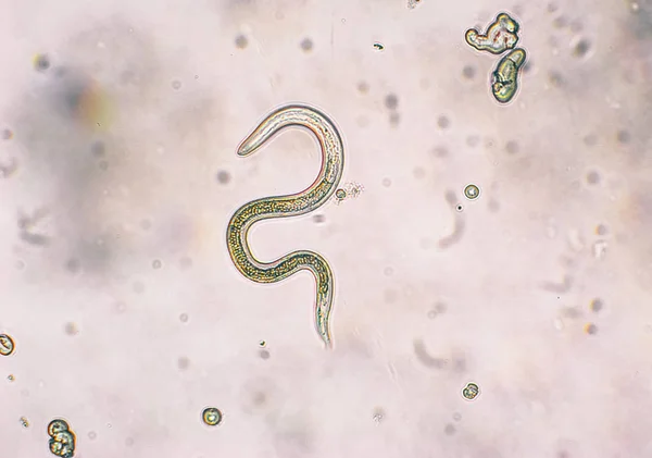 Toxocara canis Larven schlüpfen im zweiten Stadium aus Eiern — Stockfoto