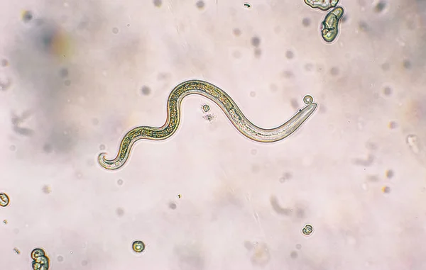 Toxocara canis segunda etapa larvas eclosionan de los huevos —  Fotos de Stock