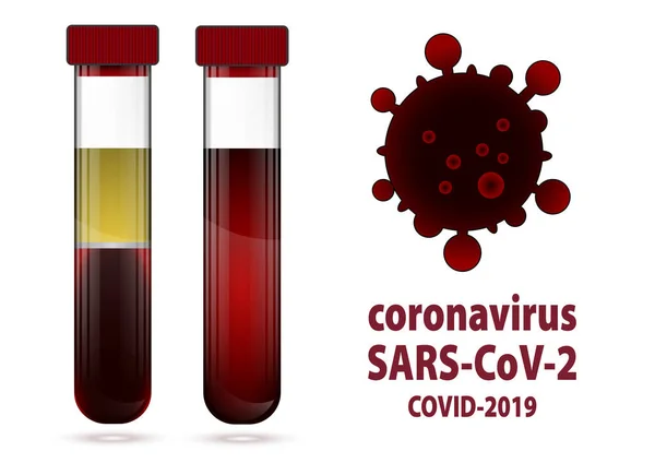 혈액 과 혈청이 들어 있는 두 개의 시험관에 코비 디온 -19 라는 라벨이 붙어 있다 — 스톡 벡터