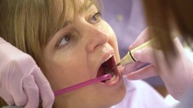 Kadın Kliniği profesyonel diş beyazlatma diş sağlığı uzmanı ve diş hekimi ve ultrason Temizleme. Odontic ve ağız sağlığı ve hijyen diş hekimliği yardım ile insan yaşamının önemli parçasıdır 