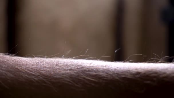 Získání husí kůži na těle člověka — Stock video