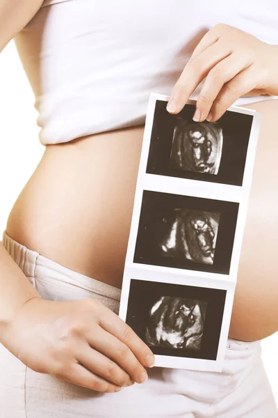 Pregnant Woman Holding Ultrasound Scan Image Baby — Stock Photo, Image