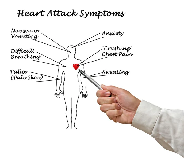 Diagramma dei sintomi di infarto — Foto Stock