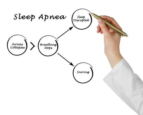 Diagrama de la apnea del sueño — Foto de Stock