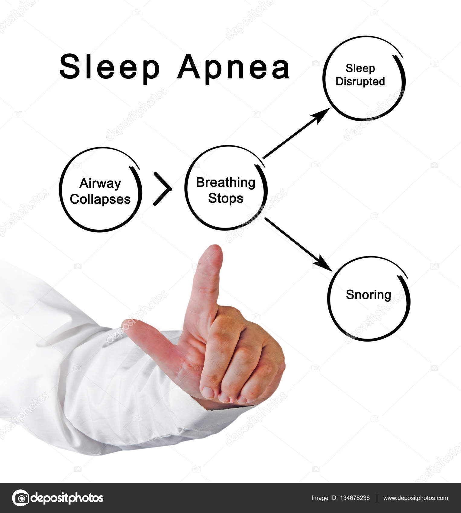 Diagram of Sleep Apnea Stock Photo by ©vaeenma 134678236