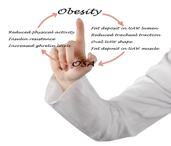 Отношения между ОСА и ожирением — стоковое фото