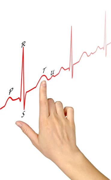 Schéma tvorby EKG — Stock fotografie