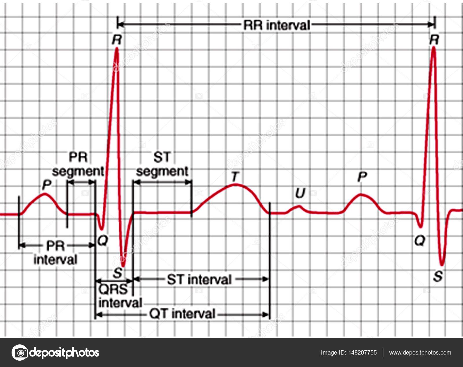 Ecg Chart