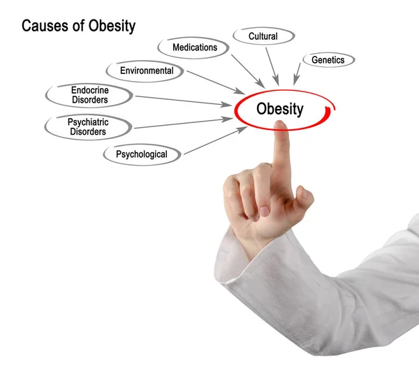 Diagram of Causes of Obesity — Stock Photo, Image