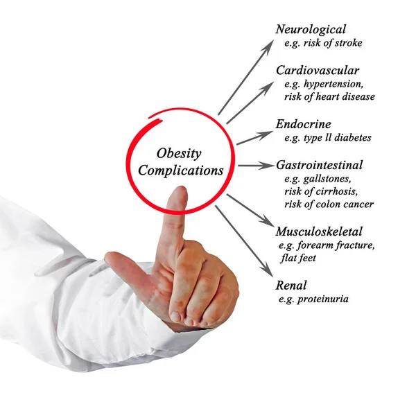 Presentación del diagrama de complicaciones de la obesidad — Foto de Stock