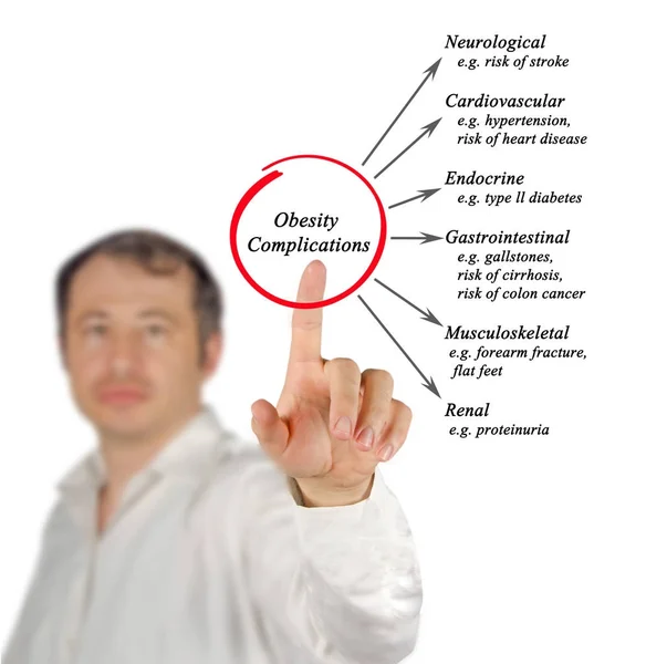 Man presenting Complications of obesity — Stock Photo, Image