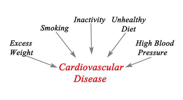 Ursachen Für Herz Kreislauf Erkrankungen — Stockfoto