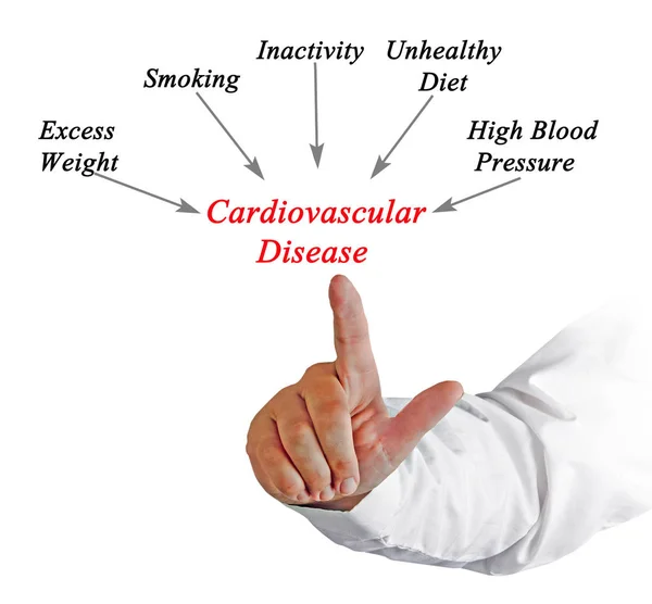 Causes to cardiovascular Disease — Stock Photo, Image