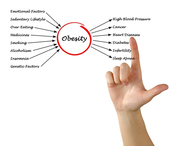 Obesitas - oorzaken en gevolgen — Stockfoto