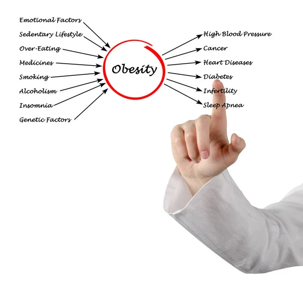 Fettleibigkeit - Ursachen und Auswirkungen — Stockfoto
